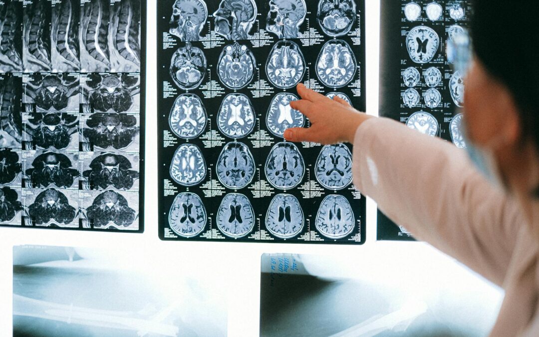 AI vs Agency: Who Should Run Your Paid Ad Campaigns?